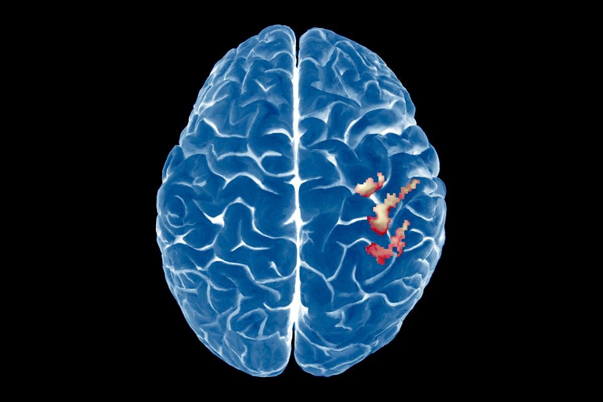 The body's brain map is amazing.Even after lost legs |American Science