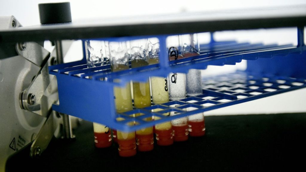 Imagen de unas muestras de orina en el Laboratorio Nacional Antidopaje de Francia en Chatenay-Malabry, a las afueras de París.